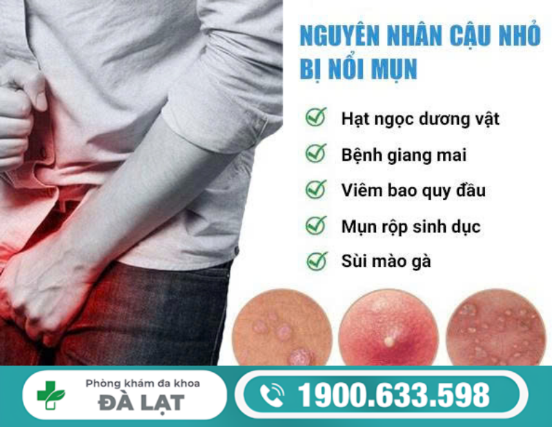 Hình ảnh minh họa